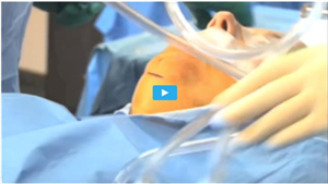 Como Baixar O Mspy De Graça